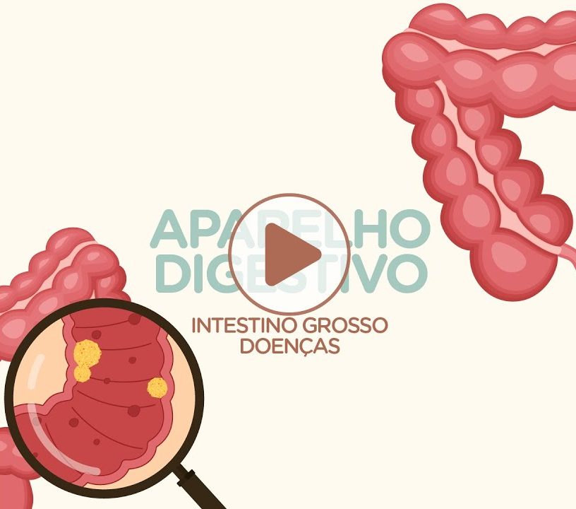 Intestino grosso