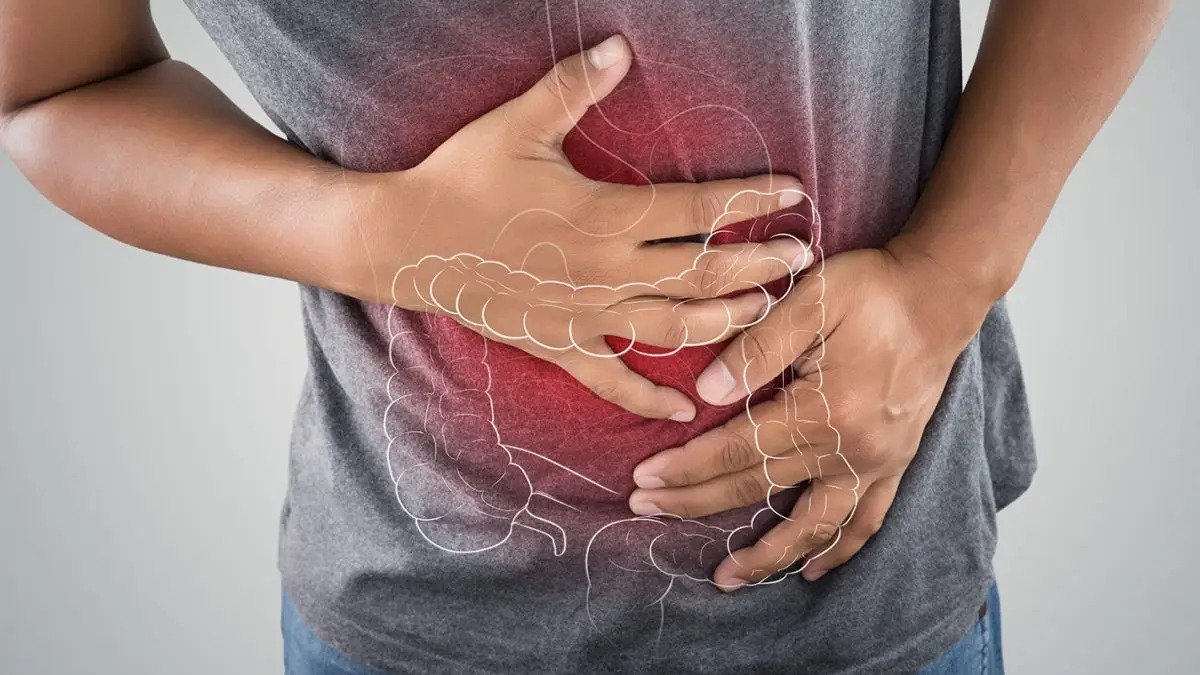 Cancro coloretal: O que é, Sintomas